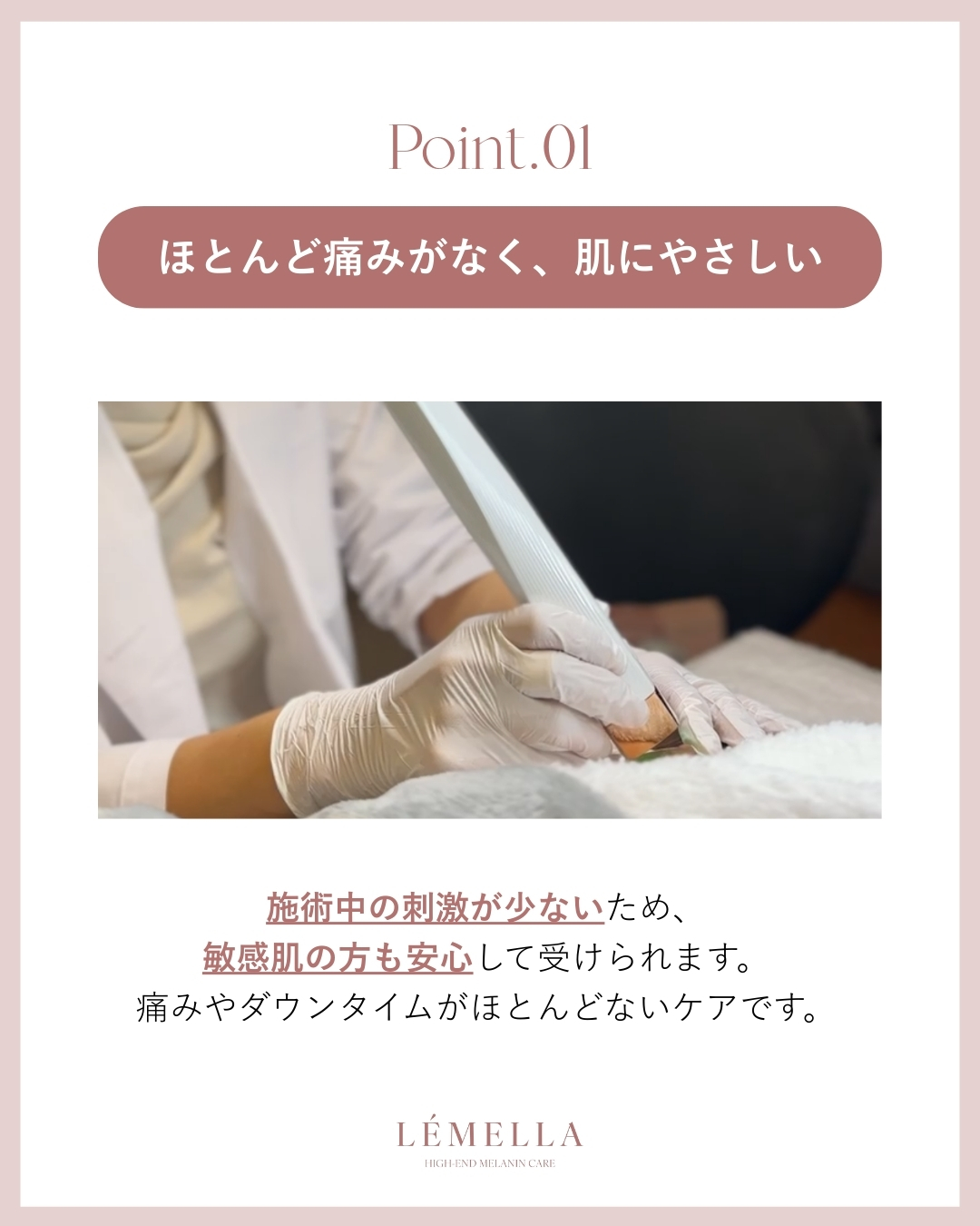 Point 1: ほとんど痛みがなく、肌に優しい