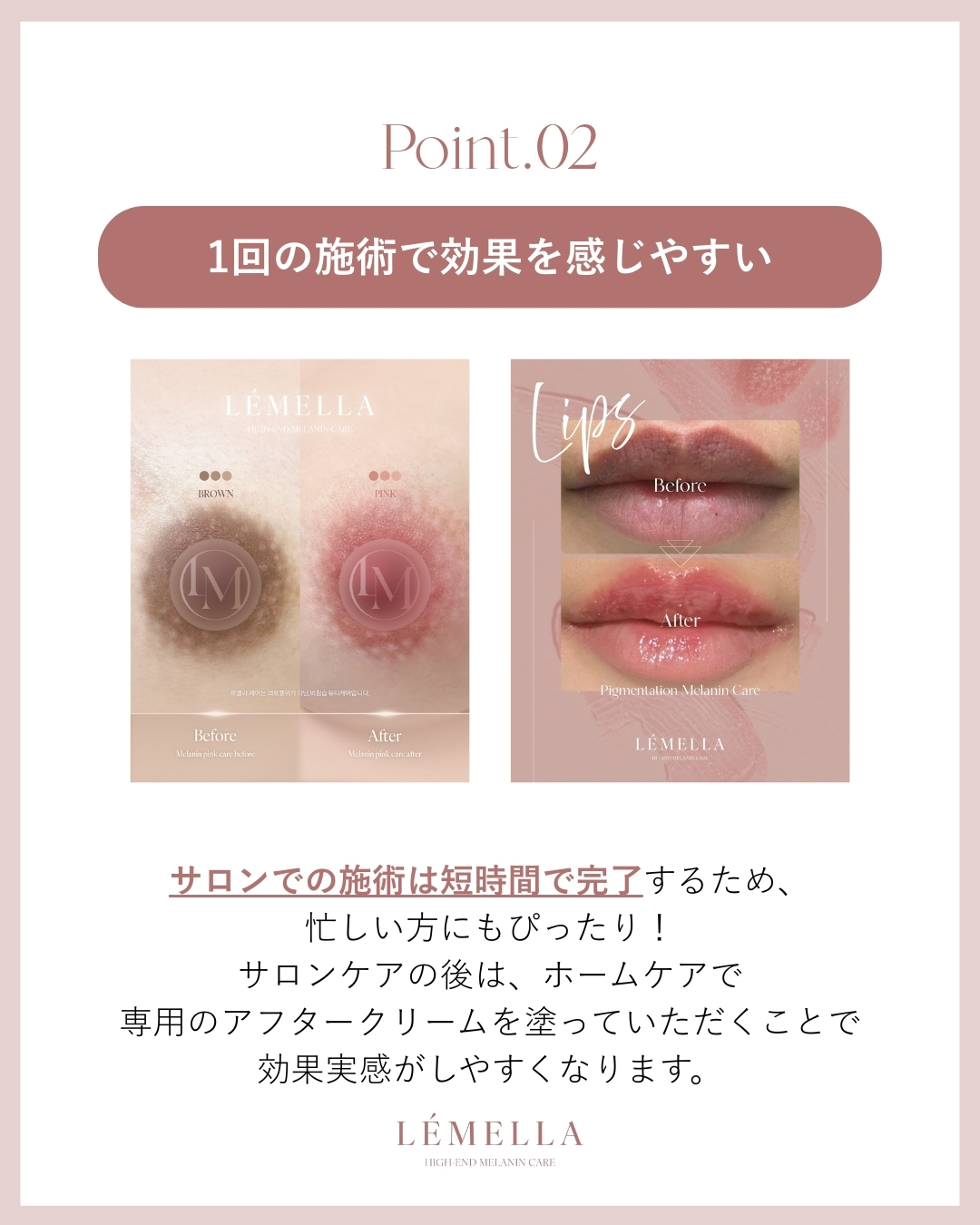 Point 2: 1回の施術で効果を感じやすい